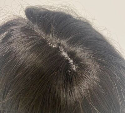 Doğal Renk Uzun Boy Alopecia Peruk Ankara - 6