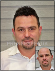 Protez Saç Toupe %100 Doğal Görüntü - 6